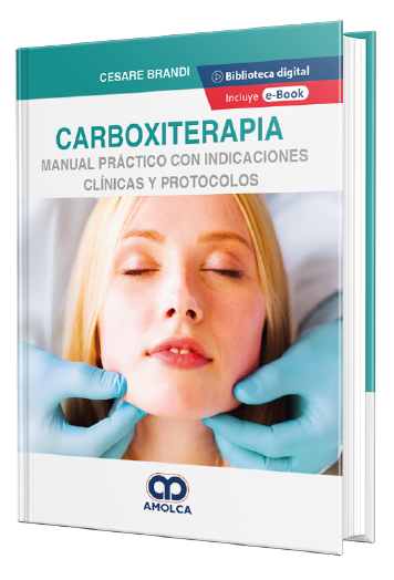 Carboxiterapia. Manual práctico con indicaciones clínicas y protocolos