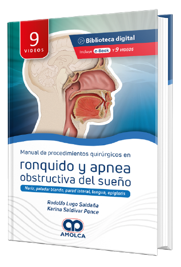 Manual de Procedimientos quirúrgicos en Ronquido y Apnea obstructiva del sueño