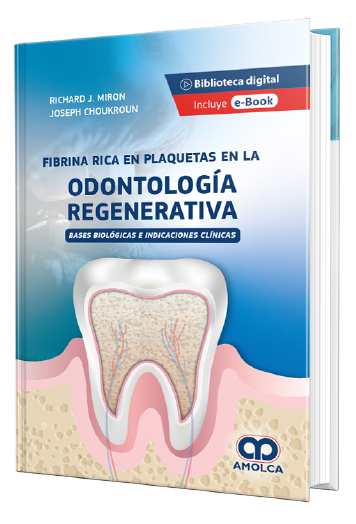 Fibrina Rica en Plaquetas en la Odontología Regenerativa