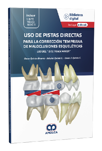 Uso de Pistas Directas para la corrección temprana de maloclusiones esqueléticas