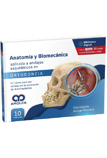 Anatomía y Biomecánica aplicada a anclajes esqueléticos en Ortodoncia