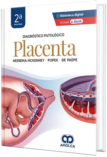 Diagnóstico patológico: Placenta - 2a Edición