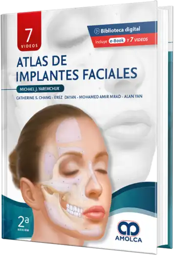 Atlas de implantes faciales