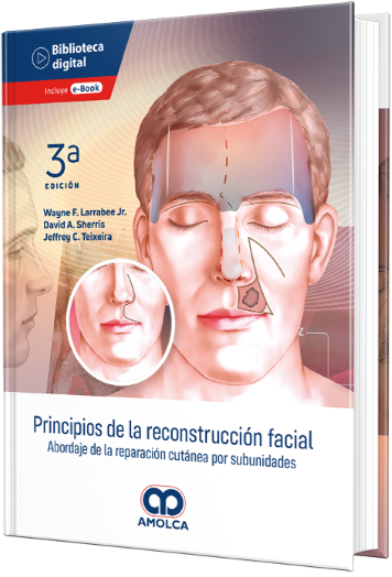 Principios de la reconstrucción facial. Abordaje de la reparación cutánea por subunidades. 3a Edición